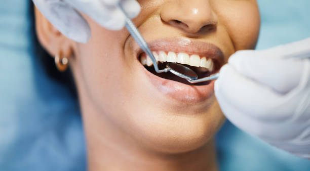 Best Emergency Treatment for Dental Infections or Abscesses in El Paso, TX