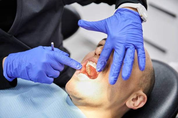 Best Emergency Treatment for Dental Infections or Abscesses in El Paso, TX