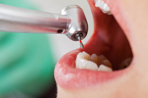 Best Emergency Denture Repair in El Paso, TX